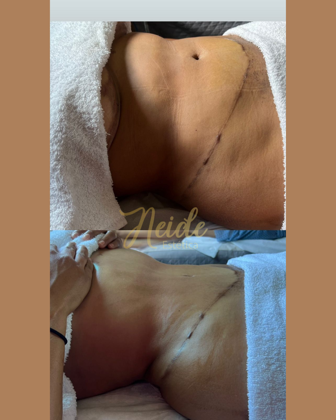Case pós-operatório 3 (fotos de trabalhos)